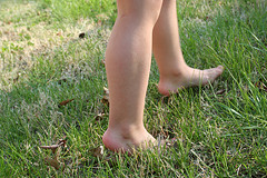 geschwollene Füße flickr (c) wheatfieldbrown CC-Lizenz